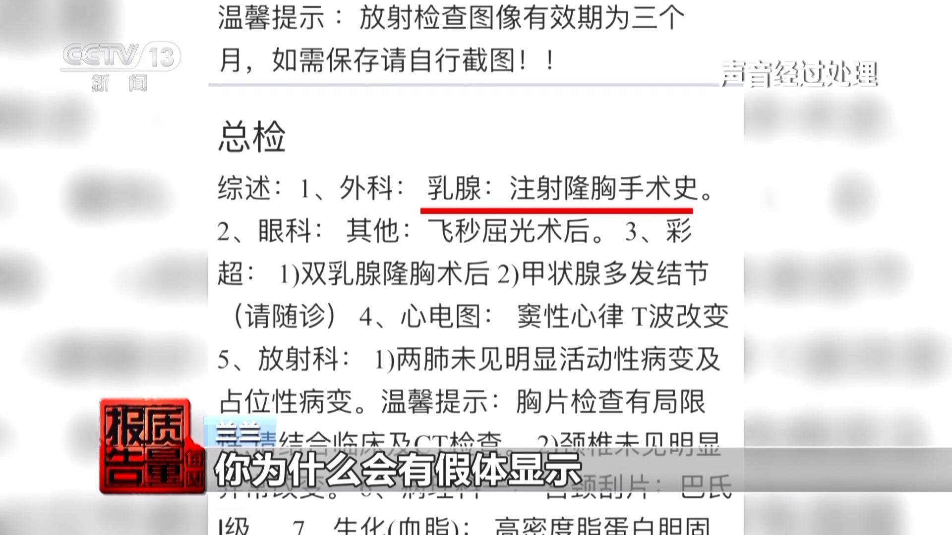 女子丰胸检出骆驼等动物源性成分